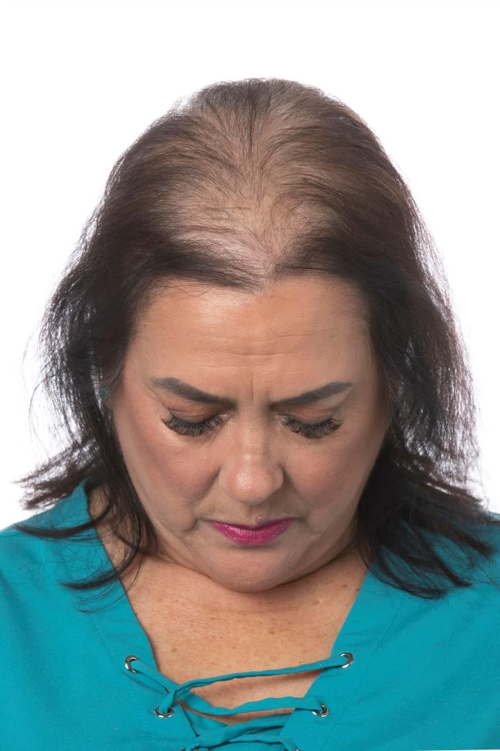 Perfect Topper by Toni Brattin | Heat-Friendly Synthetic Perfect Topper By Toni Brattin | Heat-Friendly Synthetic -Best Wig Shop TB PerfectTopper Product3 Before