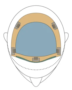 Top Form French 12" Topper By Jon Renau | Renau Exclusive -Best Wig Shop Top Form french placementTop Wave Coverage jpg c64cdcc8 761c 4f64 9bf4 cf493cda2aa5