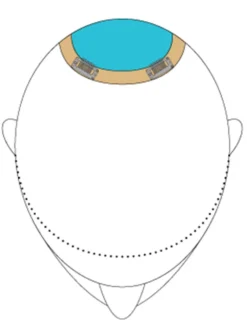 Top This 8" By Jon Renau | Remy Human Hair | Renau Exclusive -Best Wig Shop TopThis placement 65e9f77c 8719 46d0 9bf0 62c94448aa04